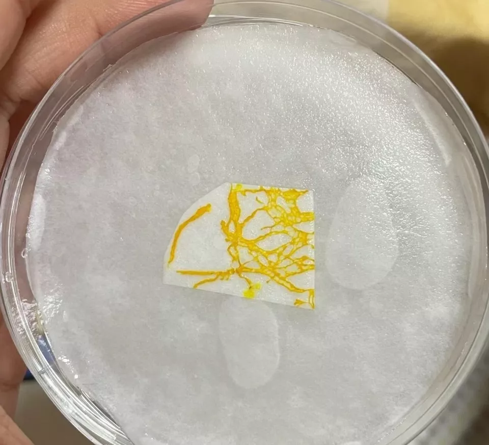 年轻人开始养黏菌当宠物，有人一株黏菌养7年多