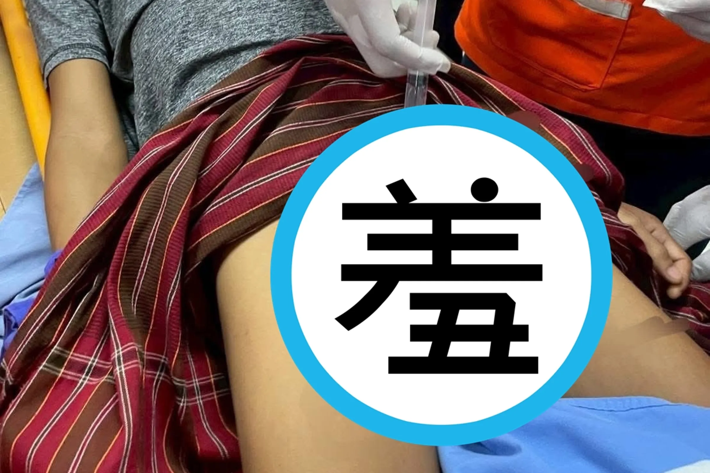 怕天赋异禀命根被偷 自锁双环 肿如拳头险坏死 怕天赋异禀命根被偷 自锁双环 肿如拳头险坏死