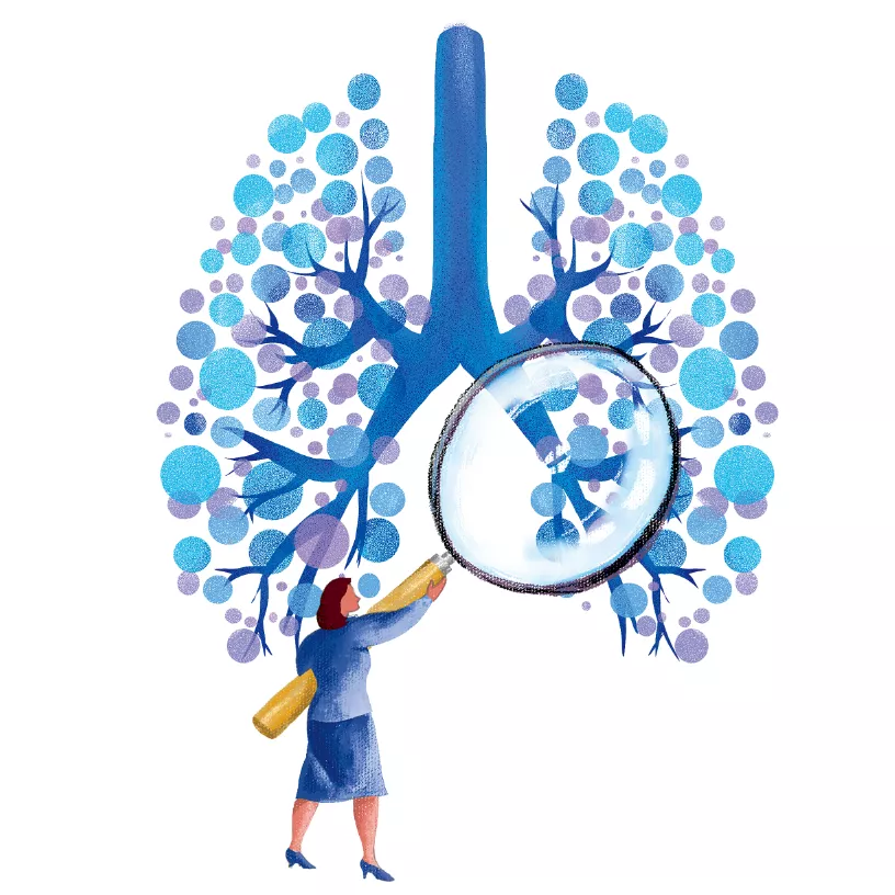 超过男性!为什么越来越多不抽烟的女性得肺癌