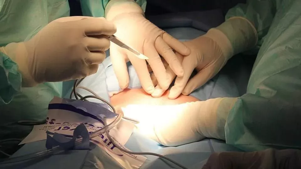 缅甸村庄“半数居民出国卖肾”！一颗能换多少钱？