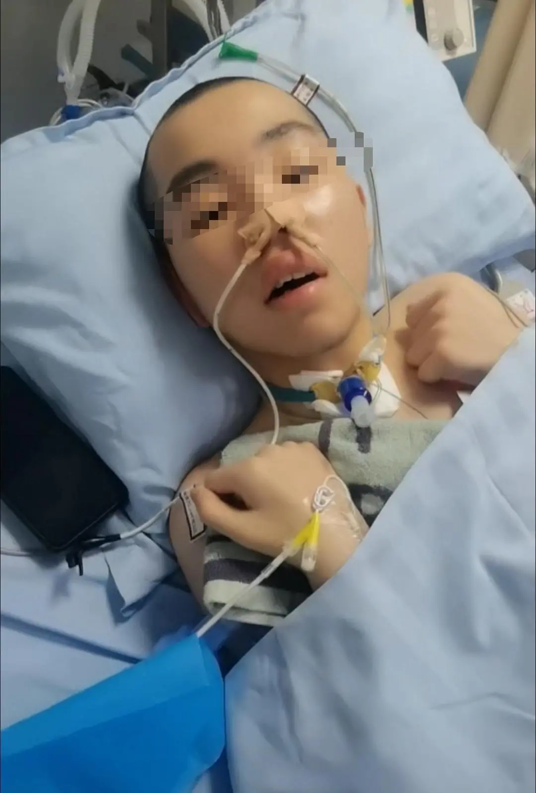 14岁男生嬉闹时被女同学打中左胸后瘫痪 女孩父母为残疾人 费用无着落