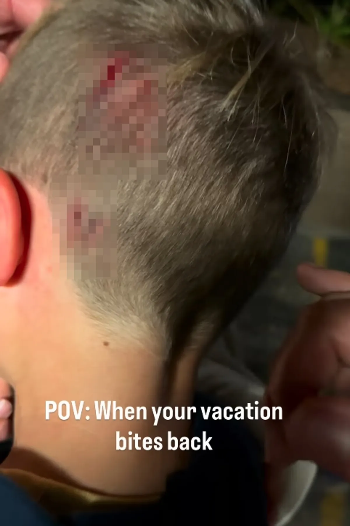 恐怖瞬间！澳洲男童动物园体验 遭蛇咬头爆血