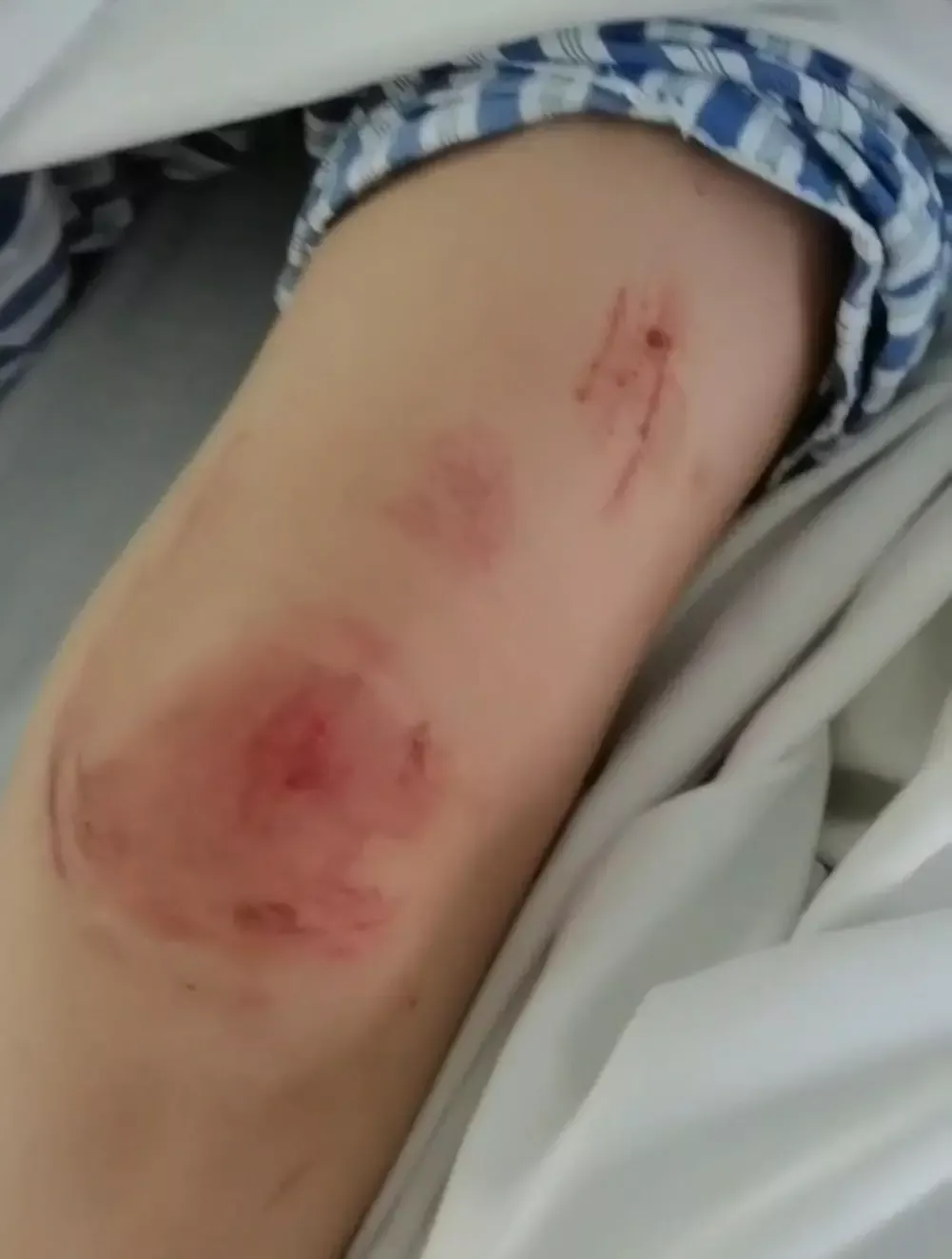 ▲曹某某身上的伤