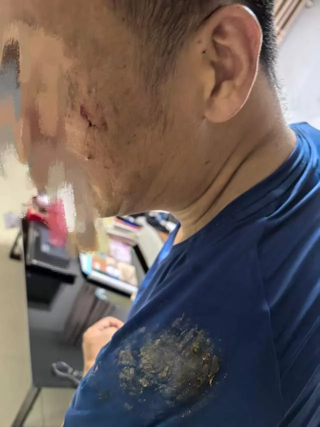 男子曝骑哈啰单车轻捏刹车却刹死，翻进花坛人受伤蔡司镜片被刮花