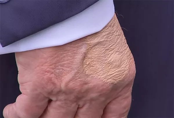 被《纽约时报》指“显露衰老迹象”,特朗普跳脚